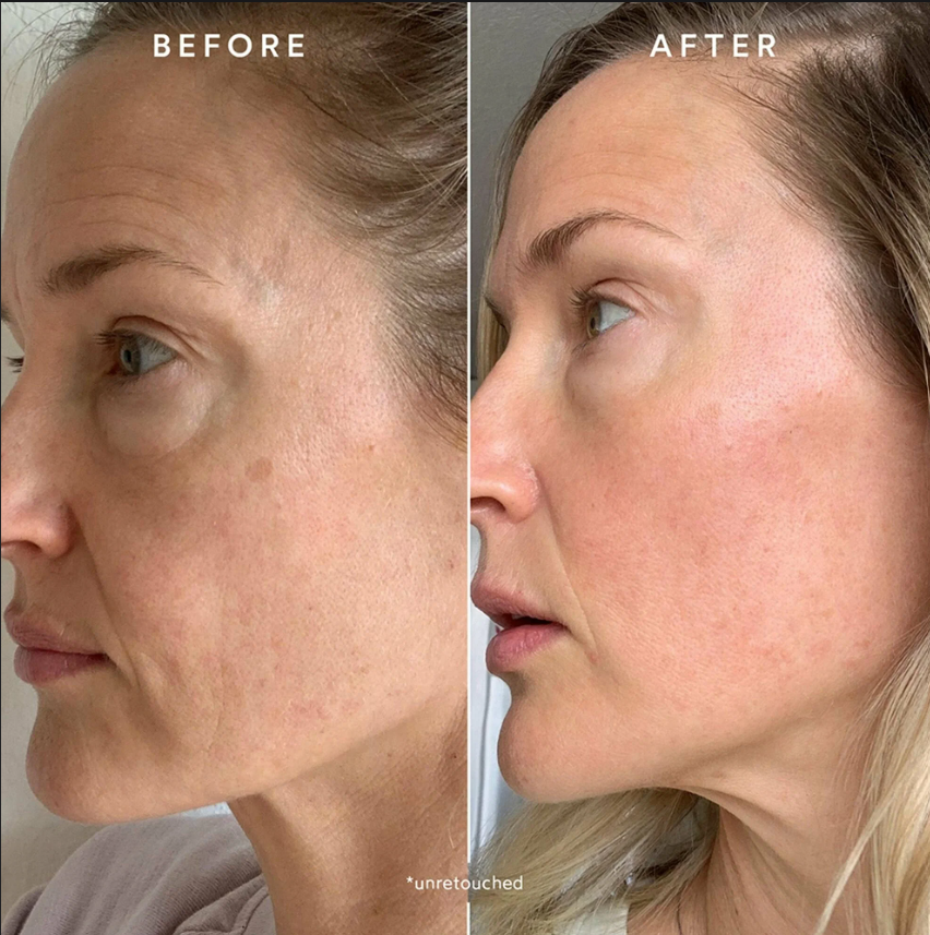 PDRN Regenerative Collagen Capsule Cream (50ml)