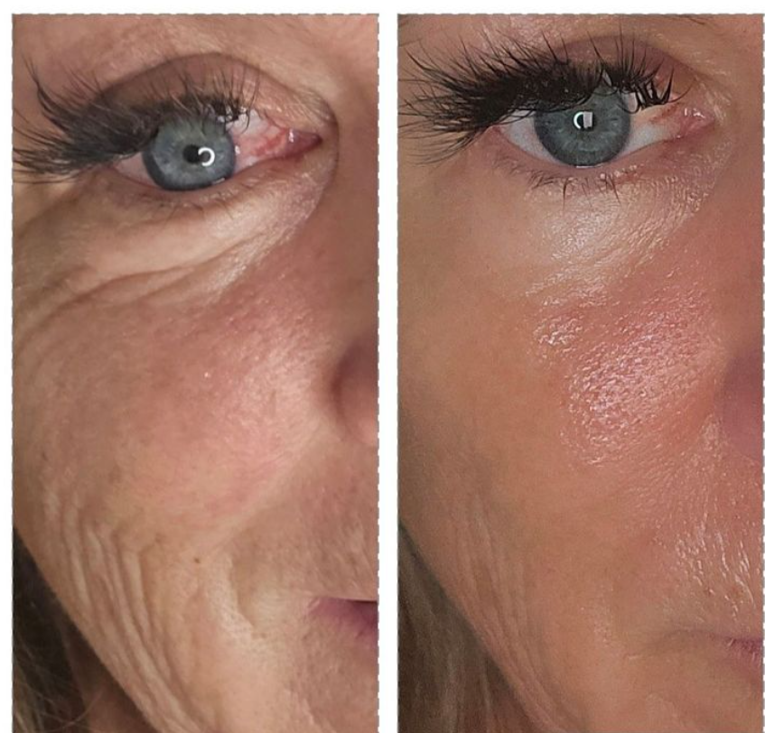 PDRN Regenerative Collagen Capsule Cream (50ml)